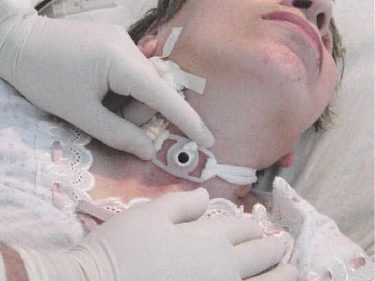 Больница №10 в Хабаровске переполнена почти в два раза...