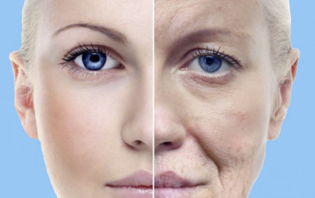 SMAS-ЛИФТИНГ УЛЬТРАЗВУКОМ - ЭФФЕКТИВНОЕ ПРЕОБРАЖЕНИЕ